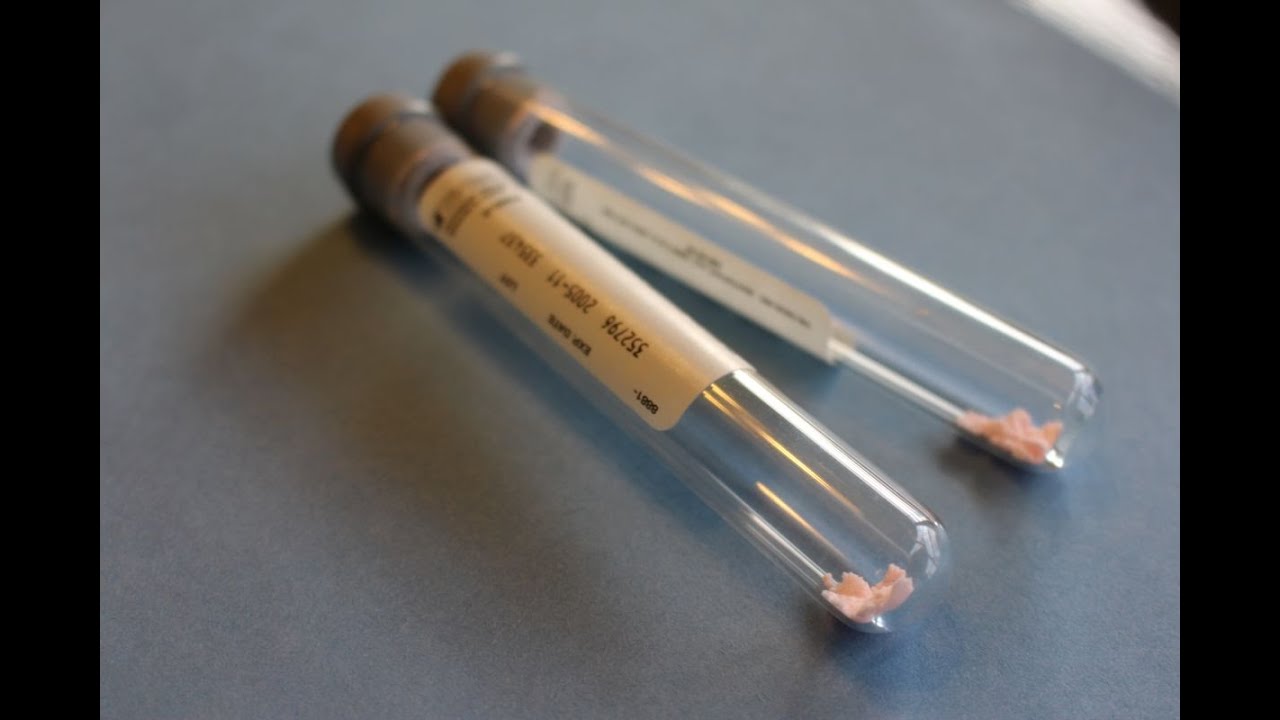 DUI Blood Testing